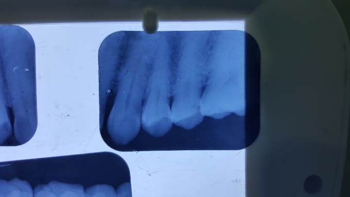 I will suggest best dental treatment options