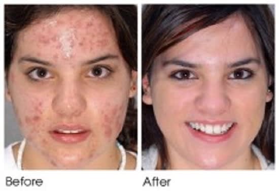 I will remove the dark spots in 10 photos