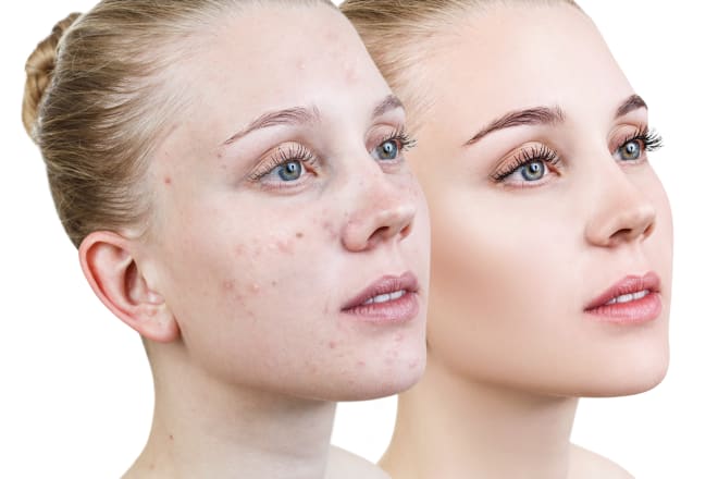 I will do photoshop editing and studio quality photo retouching