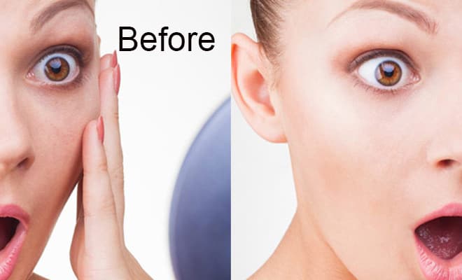 I will remove pimples, freckles and fine lines from your skin