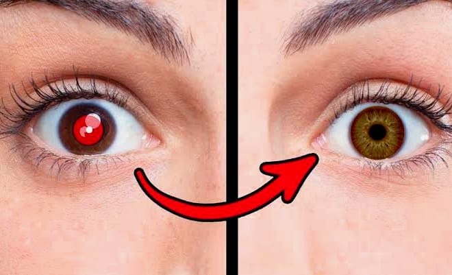 I will do remove red eye from your picture and face retching