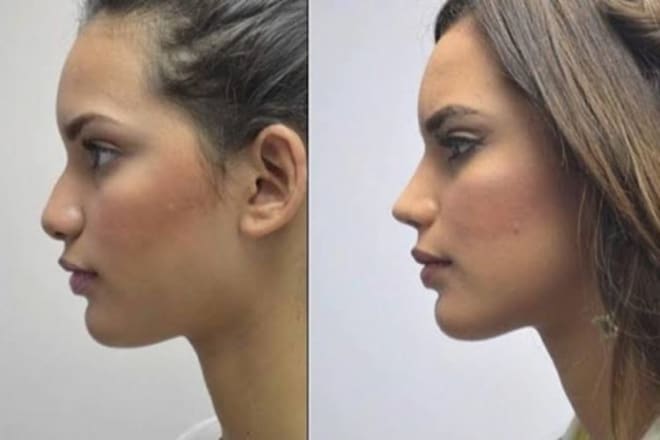 I will can fix unwanted pounds and your nose shape in pictures