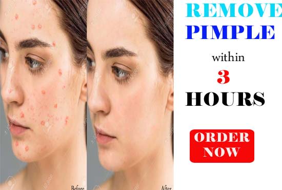 I will remove wrinkles, blemishes, spots, pimples from your skin