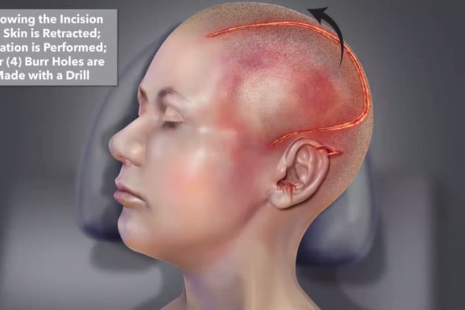 I will create the best outstanding 3d medical animation video and modelling