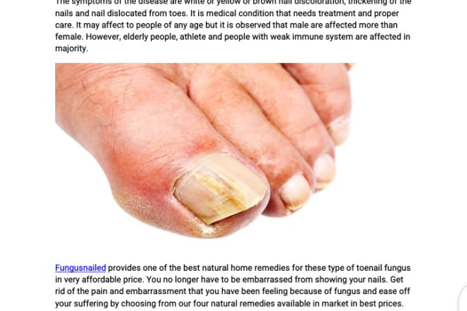 I will write medical, health articles and website content