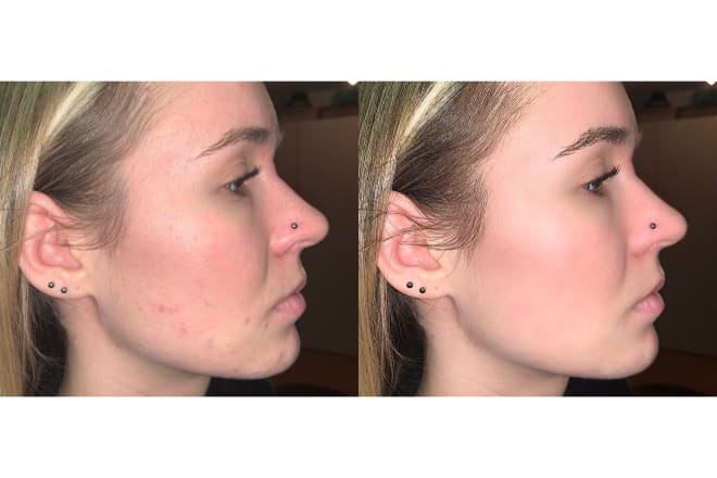 I will any photo editing retouching remove backgrounds etc